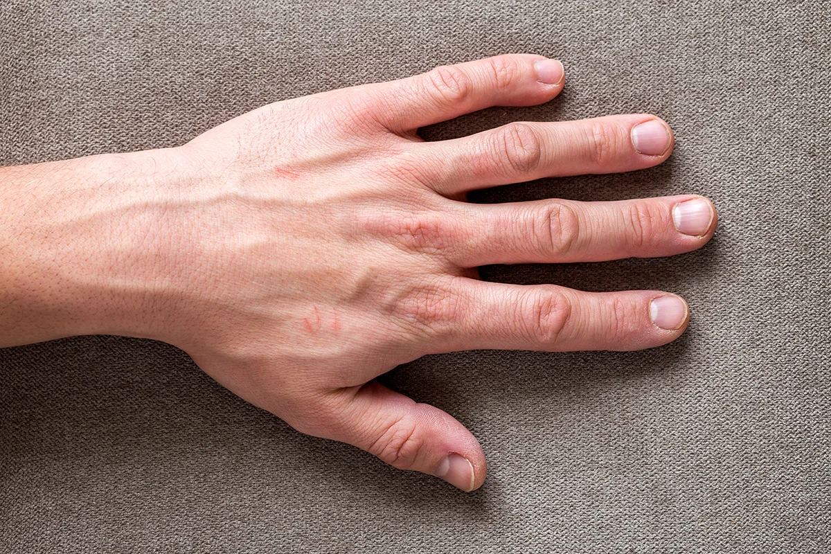 Mano apoyada sobre la mesa
