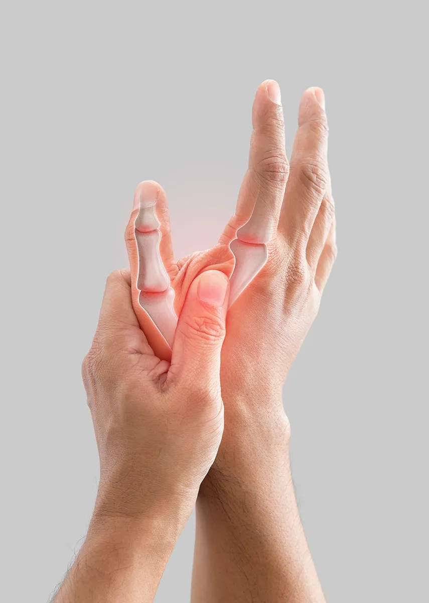 Mano con dolor de rizartrosis