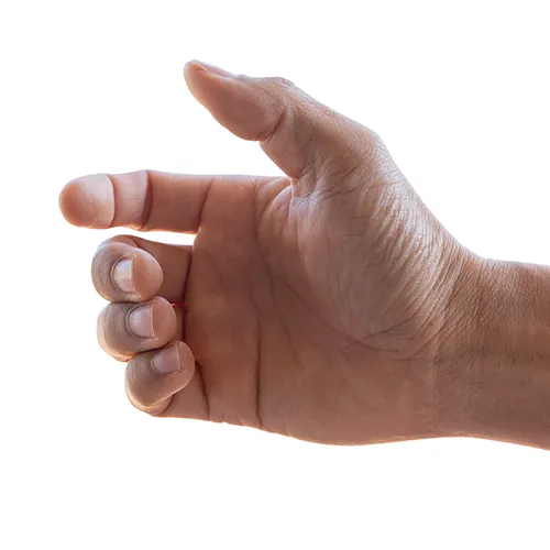 Mano con rizartrosis